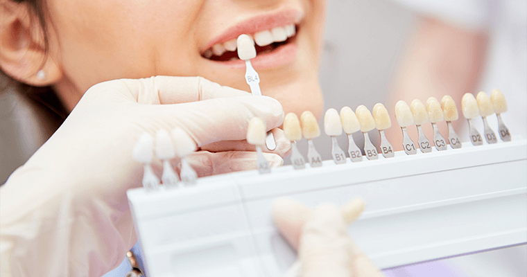 Dental implants procedure